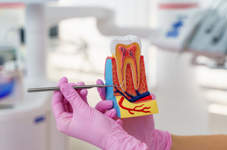 Laser Root Canal Treatments